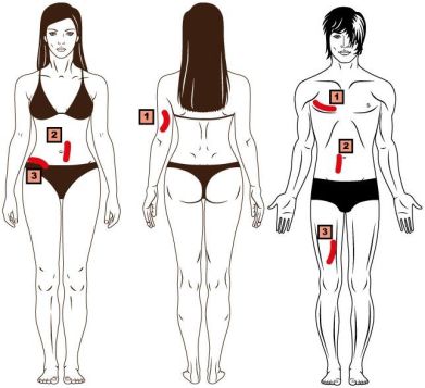 3 Faltenmethode Körperfettmessung